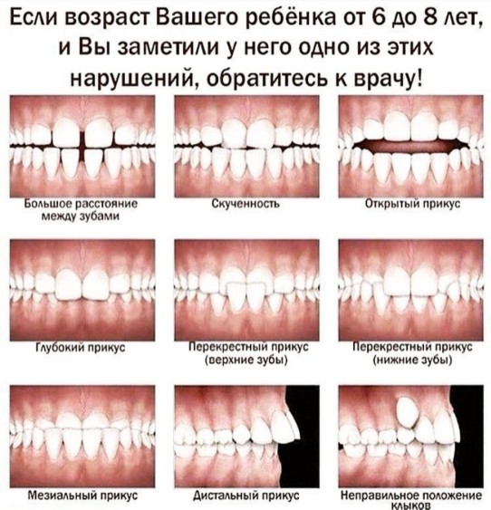 Постановка звука «Р». Упражнения для постановки звука «Р» | Центр Анны Семкиной